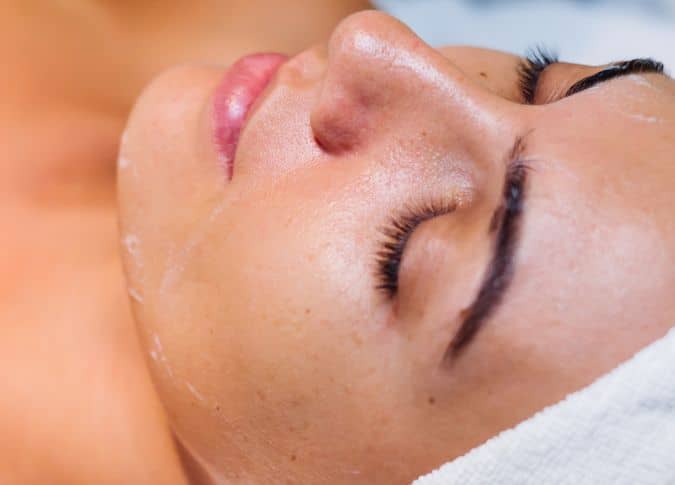 Close-up of a woman's face during RF Microneedling treatment for skin rejuvenation